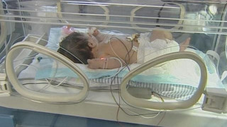 Заразиха 79 бебета с туберкулоза