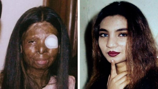 Залята с киселина от съпруга си скочи от шестия етаж