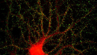 Учени заснеха как мозък създава спомени (ВИДЕО)