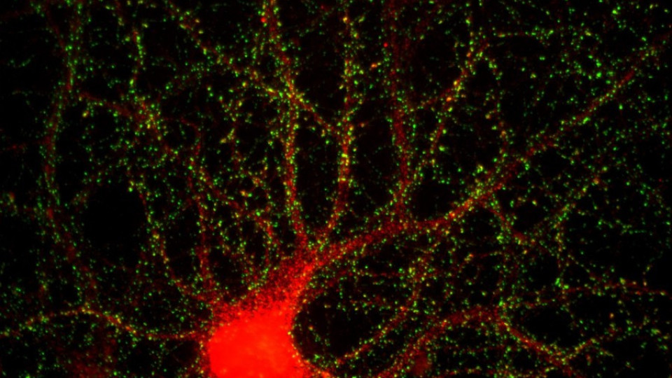 Учени заснеха как мозък създава спомени (ВИДЕО) | StandartNews.com