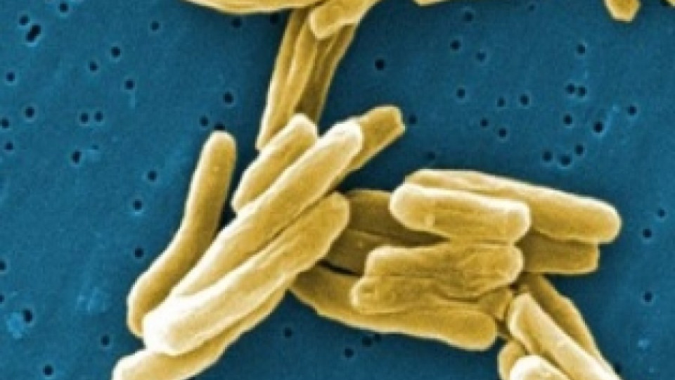 27% по-висока заболеваемост от туберкулоза в Сливенско | StandartNews.com