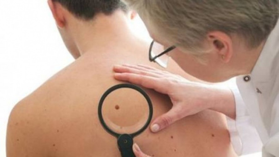 Безплатни прегледи за рак на кожата в столицата | StandartNews.com