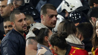 Бой и счупени глави преди мача на Англия