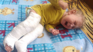 Бебе в гипс след масаж в Кюстендил
