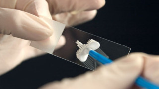 Без паника, ако носите HPV вирус