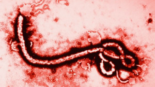 Оцелели от ебола 3 месеца без секс