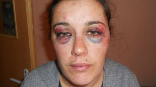 Зверски пребита майка на 8-ми март: Борех се докрай