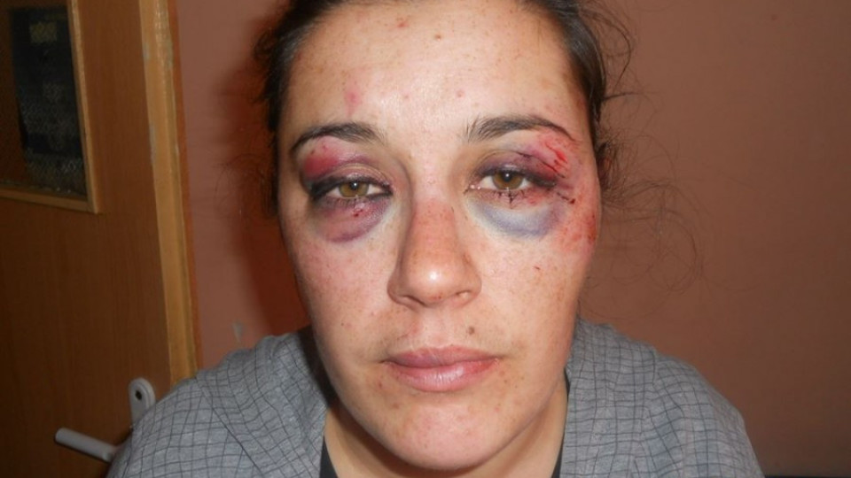 Зверски пребита майка на 8-ми март: Борех се докрай | StandartNews.com