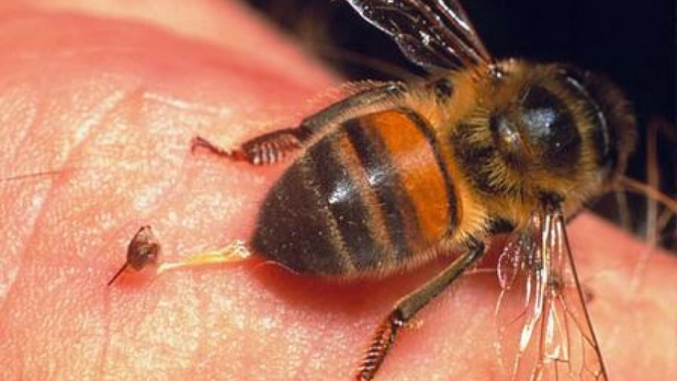 Спасиха живота на 150-килограмов мъж след ухапване от пчела | StandartNews.com