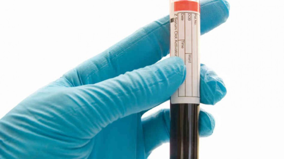 Кръвен тест предрича смъртта | StandartNews.com
