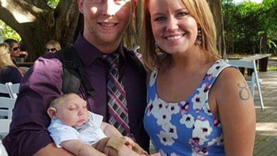 Чудо: Бебе с половин череп благодари (ВИДЕО) | StandartNews.com