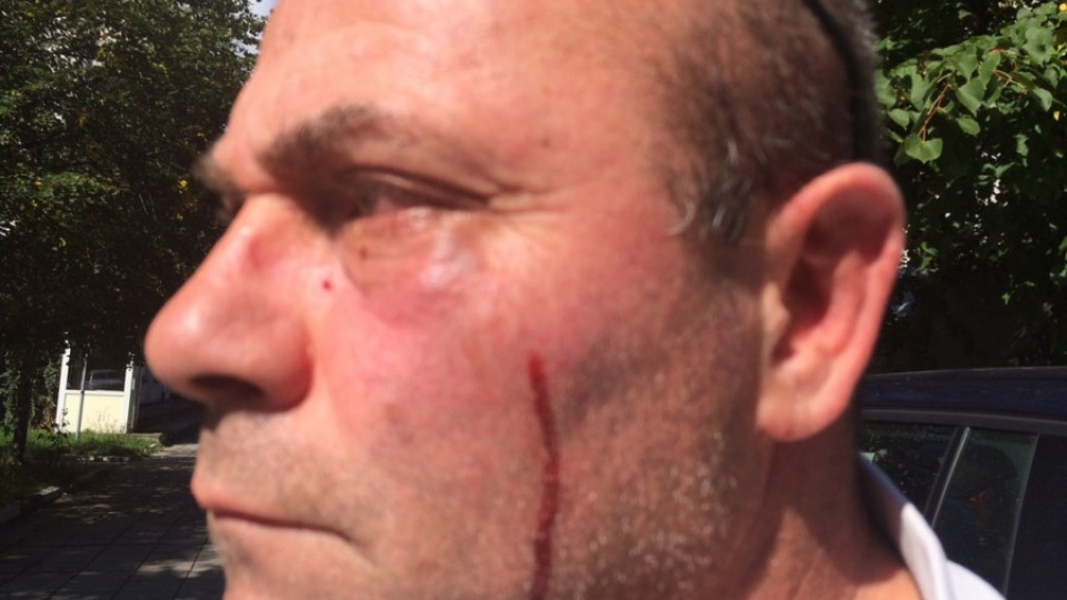 Роми нападнаха и пребиха репортери на Нова в Самоков | StandartNews.com