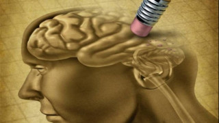 Учени: Очаква ни епидемия от Алцхаймер