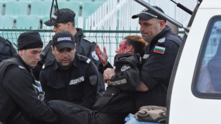 Пострадалата полицайка от ЦСКА-Левски запазва зрението си
