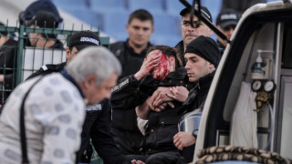 Фенът, ранил полицайката, сам се предал