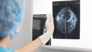 РЕВОЛЮЦИЯ: Излекуваха рак на гърдата с разсейки