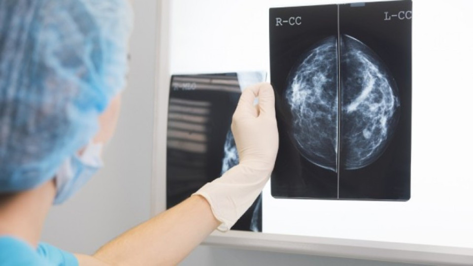 РЕВОЛЮЦИЯ: Излекуваха рак на гърдата с разсейки | StandartNews.com