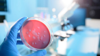 Дете от Съединените щати се възстановява от чума