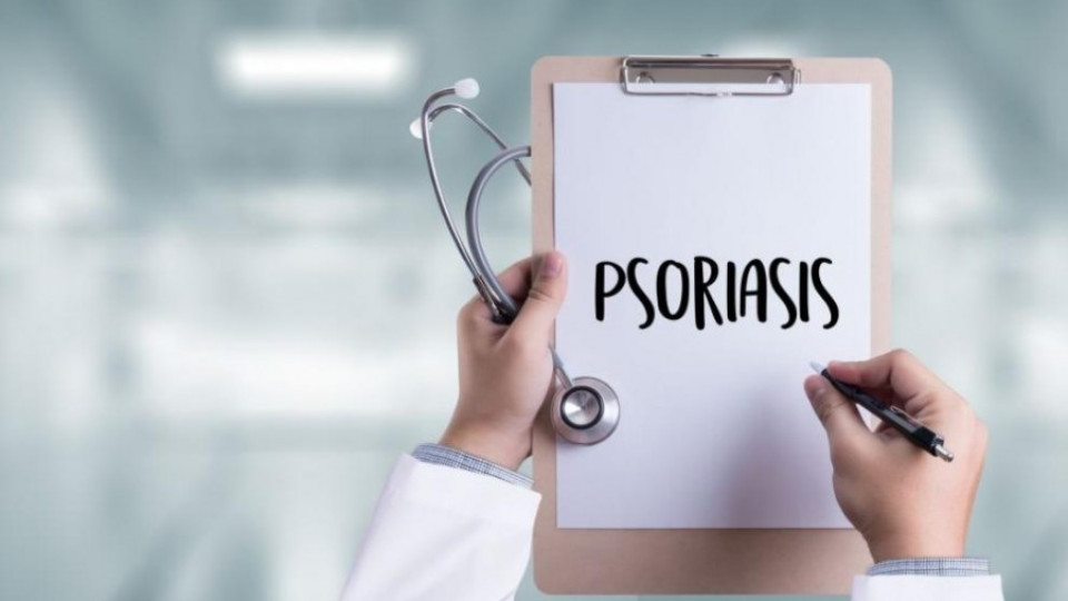 Преразглеждат решение, затрудняващо достъпа до биологично лечение на псориазис | StandartNews.com