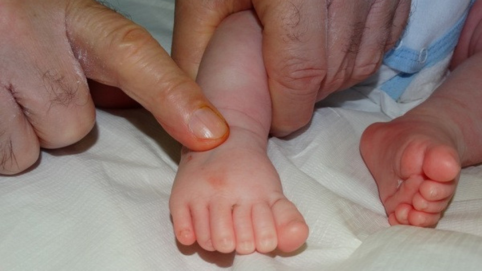 Оперерираха бебе с по 6 пръста  на ръцете и на краката | StandartNews.com