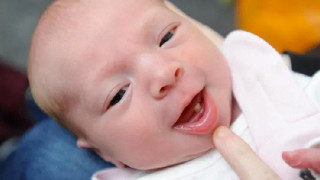 Бебе във Великобритания се роди с млечен зъб
