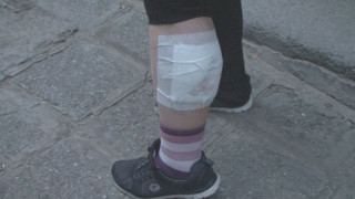 Питбул нарани сериозно крака на жена в Асеновград