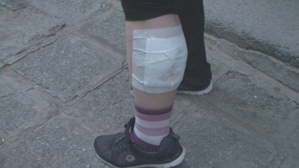 Питбул нарани сериозно крака на жена в Асеновград | StandartNews.com