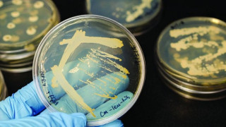Наномрежа със златно покритие унищожава бактериите
