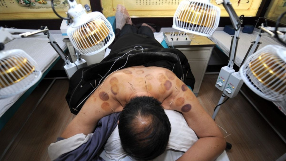 Лекари скочиха срещу китайската медицина | StandartNews.com