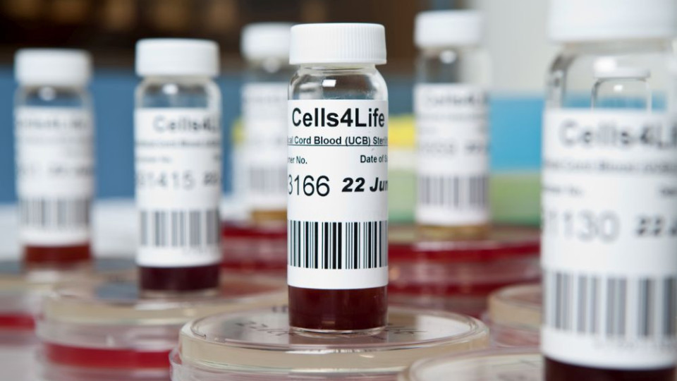 Заблудата за стволови клетки с метода TotyCyte на Cells4life | StandartNews.com