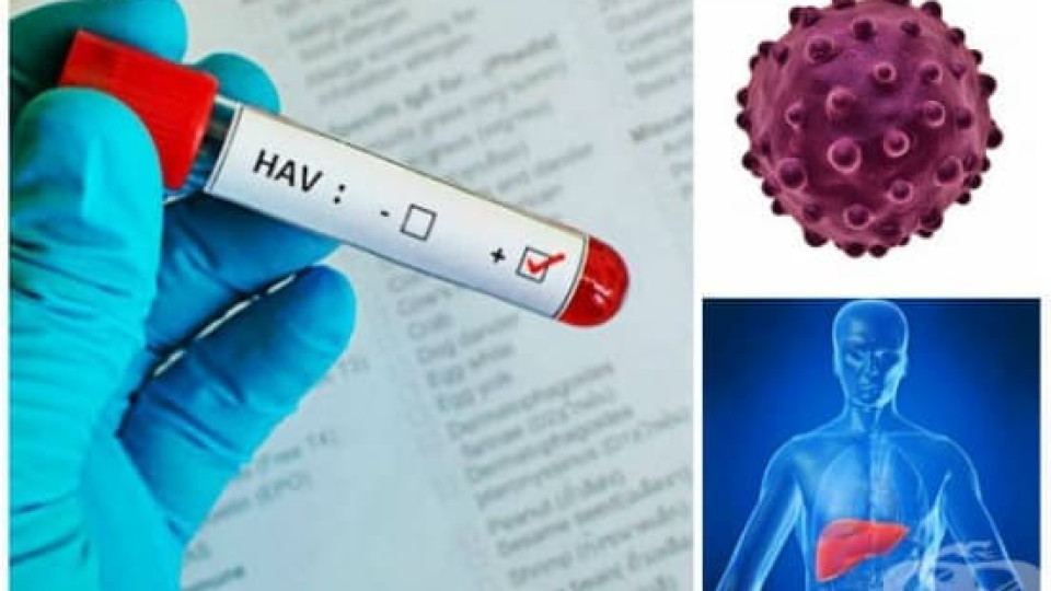 Бум на хепатит А в Бобов дол | StandartNews.com