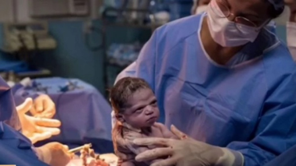 Изродиха най-намръщеното бебе | StandartNews.com