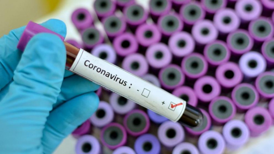 Наблюдават 17 души за коронавирус в Сливен | StandartNews.com