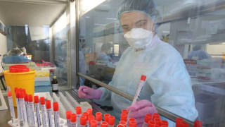 Руска ваксина за COVID-19 прилича на кисело мляко