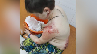 10-годишно дете нахапано жестоко от кане корсо