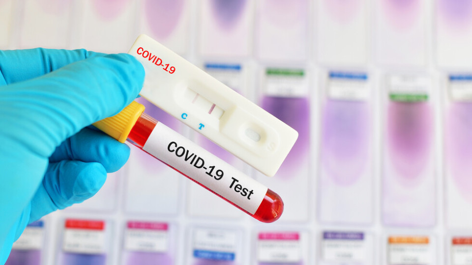 Опашки пред лабораториите за PCR за Гърция | StandartNews.com