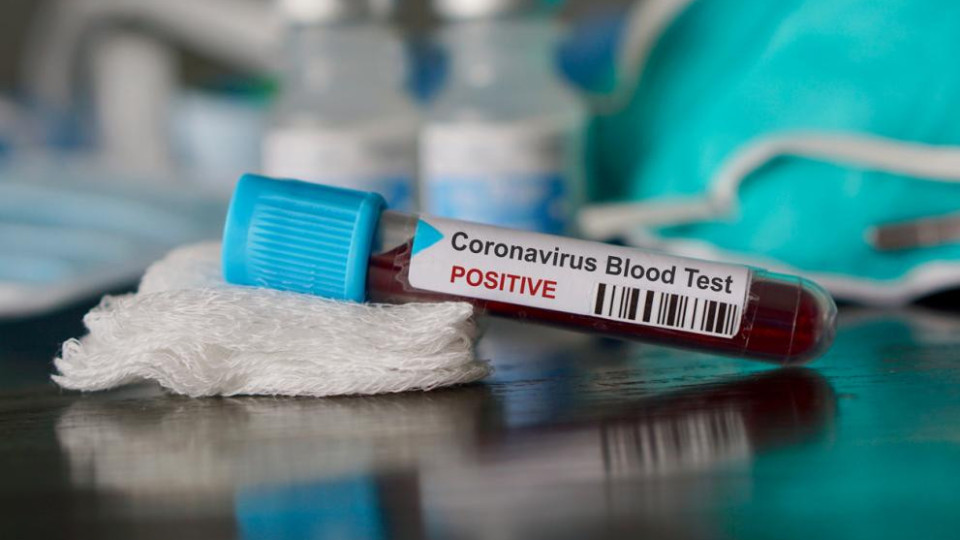 6 варианта на коронавируса | StandartNews.com