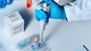 PCR направление след положителен тест за антитела