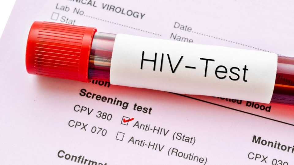 Сензация: Жена пребори ХИВ без лечение | StandartNews.com
