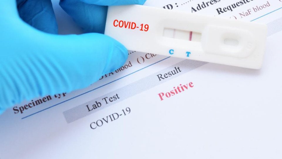 Учени казаха колко са ефикасни антигенните тестове | StandartNews.com