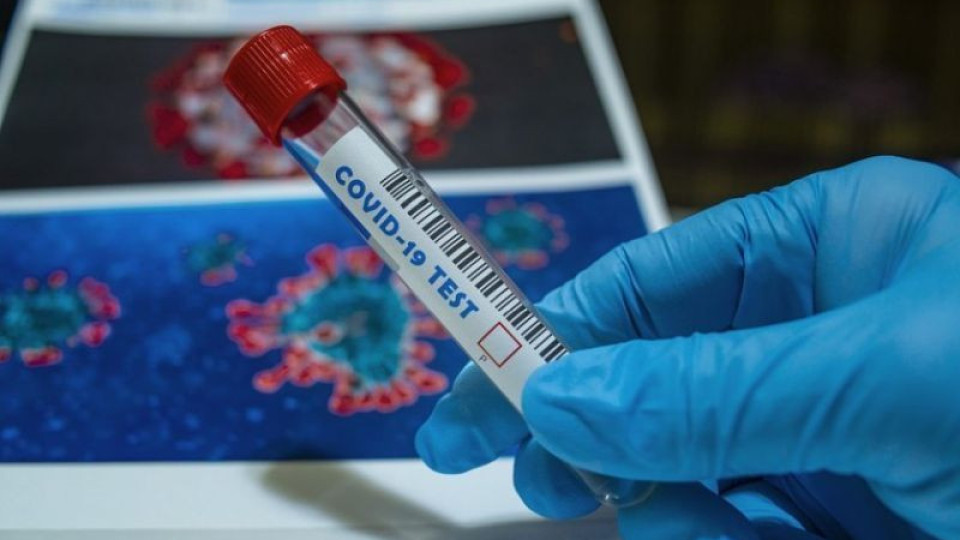 Мисия възможна ли е безплатният PCR тест от джипи | StandartNews.com