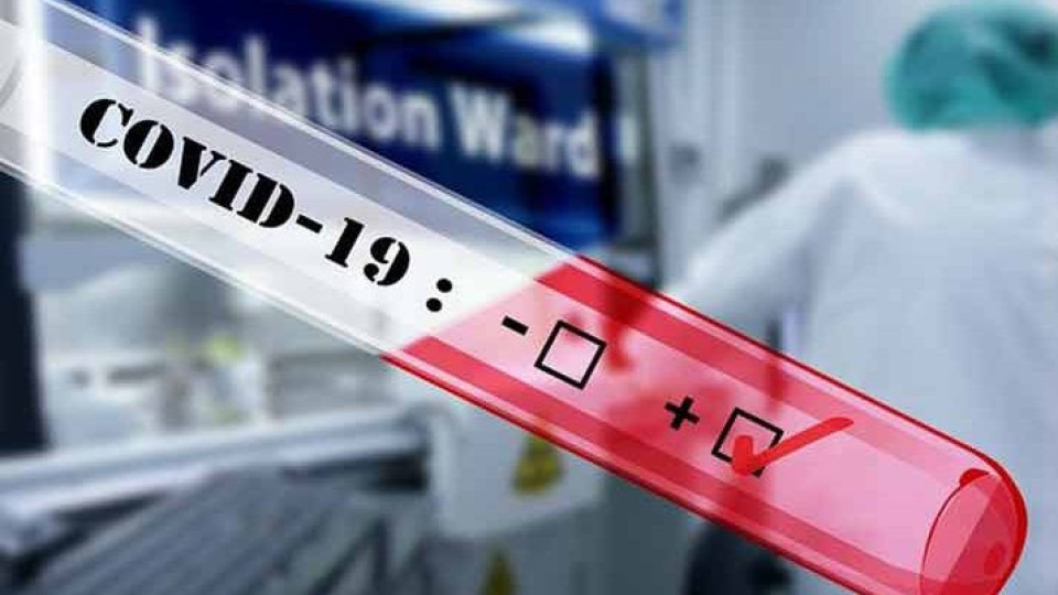 Над 42% от PCR-тестовете са положителни | StandartNews.com