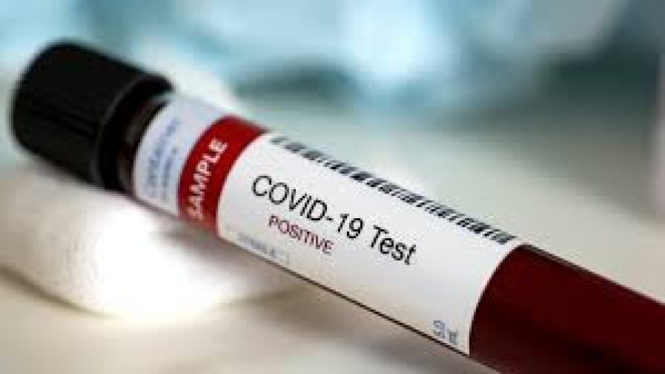 Намериха нови антитела срещу Covid-19 | StandartNews.com