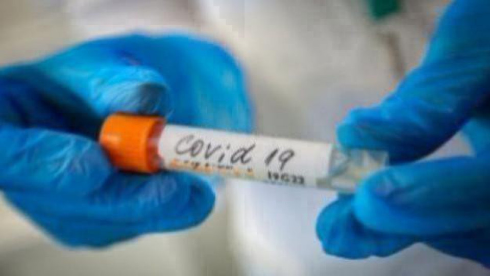 Скок на заразените и починалите от COVID | StandartNews.com