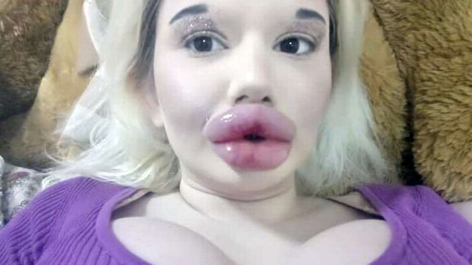 Андреа - българката с най-огромните устни в света | StandartNews.com