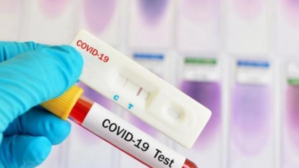 Къде да се тестваме безплатно за COVID | StandartNews.com