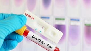 Лекар: PCR хваща ковид на третия ден след появата на симптоми