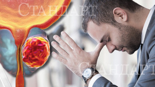 "Тайната" болест или защо се страхуват мъжете?