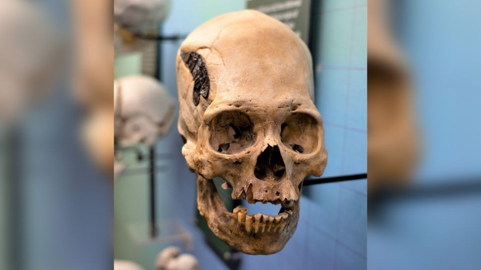 Пълна мистерия! Древен череп с чип смути учените | StandartNews.com