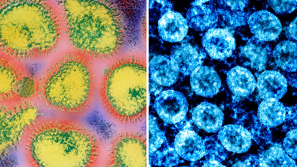 Какво става ако ни атакуват грип и ковид? Отговаря вирусолог | StandartNews.com